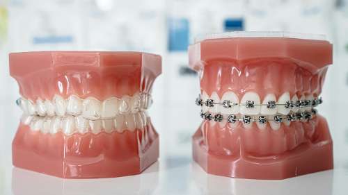 Before and after photo showcasing Braces results in Scarborough, ON