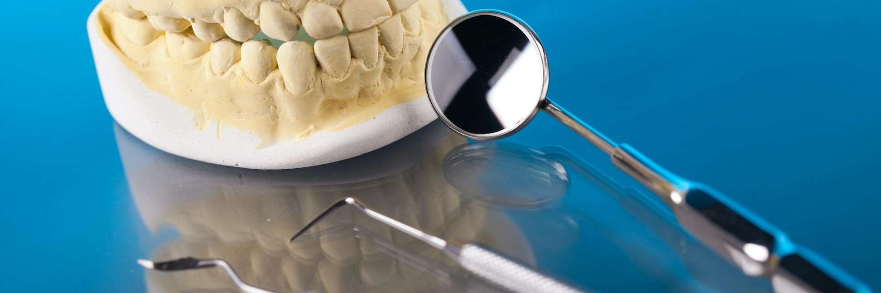 An illustration of Root Canal in Scarborough, ON